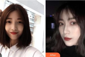 長(zhǎng)春華璦美容醫(yī)院劉兵整形價(jià)格表附眼部綜合案例展示