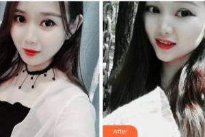 長春拜博口腔醫(yī)院周文整形價(jià)格表附牙齒隱形矯正案例展示