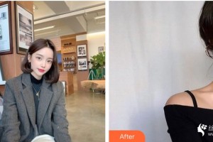 咸陽(yáng)華爾醫(yī)療美容門診部王虹力整形價(jià)格表附皮膚美容案例展示