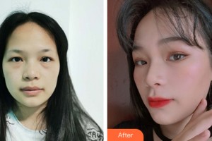 烏魯木齊新奇特醫(yī)療美容診所劉春燕整形價(jià)格表附皮膚美容案例展示