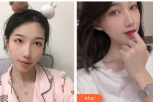 松原富華整形美容醫(yī)院夏清海整形價(jià)格表附鼻部綜合案例展示