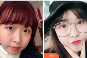 寶雞韓美醫(yī)療美容門診部苗一鳴整形價(jià)格表附牙齒隱形矯正案例展示