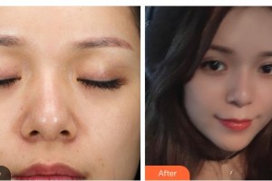 寶雞韓美醫(yī)療美容門診部金修永 整形價(jià)格表附眼部綜合案例展示