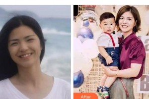 遵義利美康整形美容醫(yī)院陳學(xué)會(huì)整形價(jià)格表附牙齒隱形矯正案例展示