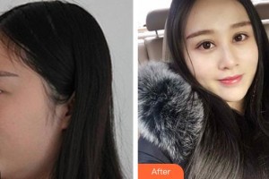 銅仁韓美時(shí)光醫(yī)療美容門診部張葉軍整形價(jià)格表附眼部綜合案例展示