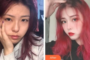 黔西南興義京州口腔醫(yī)院侯鎮(zhèn)婷整形價(jià)格表附美白貼片案例展示