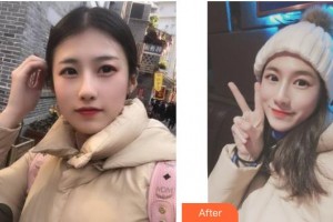 武警廣西總隊(duì)醫(yī)院醫(yī)學(xué)整形美容中心夏天整形價(jià)格表附美白導(dǎo)入案例展示