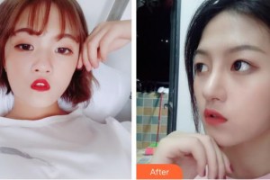 北海美秀中禾醫(yī)療美容診所謝詩(shī)涓整形價(jià)格表附眼部綜合案例展示