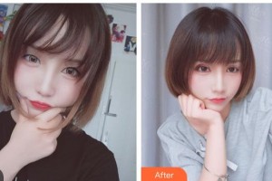 玉林愛爾眼科醫(yī)院劉偉民整形價(jià)格表附切開雙眼皮案例展示