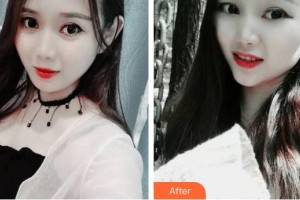 江陰艾爾美醫(yī)療美容診所李亨教整形價(jià)格表附牙齒隱形矯正案例展示