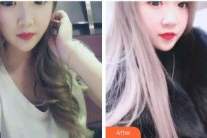 江陰牙博士口腔門(mén)診部董偉鵬整形價(jià)格表附金屬托槽矯正案例展示