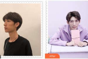 江陰牙博士口腔門診部馮小勝整形價(jià)格表附牙齒隱形矯正案例展示