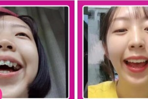 江陰牙博士口腔門診部于庭波整形價(jià)格表附金屬托槽矯正案例展示