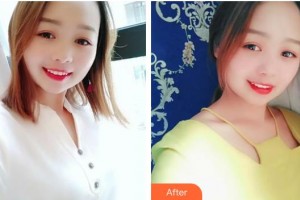 江陰牙博士口腔門(mén)診部桂禮朋整形價(jià)格表附活性牙模美白案例展示