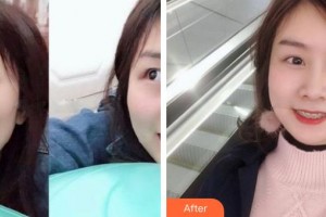 江陰金誠(chéng)口腔門(mén)診部馬泉生整形價(jià)格表附金屬托槽矯正案例展示