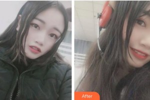 ?？诤佳谰S信口腔門診部方略宇整形價(jià)格表附牙齒隱形矯正案例展示