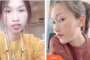 ?？诘露骺谇婚T診部朱平整形價(jià)格表附金屬托槽矯正案例展示