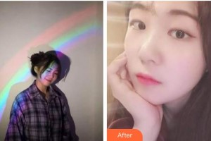 海口杭牙維信口腔門診部曾婷整形價(jià)格表附超聲波潔牙案例展示