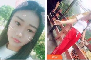 海口望?？谇婚T診部陳新整形價(jià)格表附美白貼片案例展示