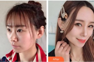 ?？诩t妝尚醫(yī)療美容門診部吳健整形價(jià)格表附眼部綜合案例展示