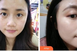 海口紅妝尚醫(yī)療美容門診部姚志文整形價(jià)格表附激光美膚激光案例展示