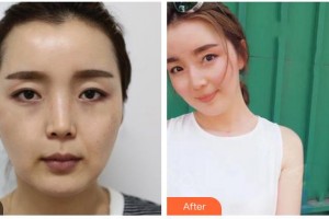 ?？诩t妝尚醫(yī)療美容門診部郭理霖整形價(jià)格表附熱拉提案例展示