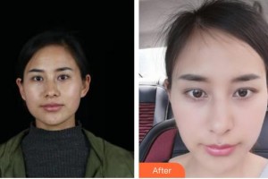 揚(yáng)州施爾美醫(yī)療美容醫(yī)院李微整形價(jià)格表附微針?biāo)獍咐故?>
</a>
<h3 class=