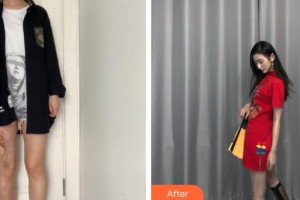 荊州市第二人民醫(yī)院整形激光美容中心謝磊整形價格表附微創(chuàng)疤痕修復(fù)案例展示