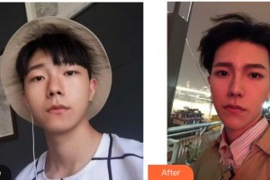 荊州市婦幼保健院眼科韓敏杰整形價格表附眼部綜合案例展示