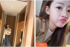 荊州沙市區(qū)楚星口腔門診部梁春紅整形價(jià)格表附牙齒隱形矯正案例展示