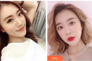 黃岡愛(ài)爾眼科醫(yī)院汪萍整形價(jià)格表附開(kāi)外眼角案例展示