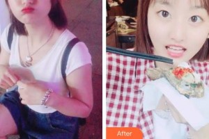 鄂州中山口腔醫(yī)院曹偉整形價(jià)格表附美白劑美白牙齒案例展示