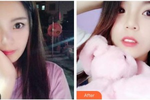 鄂州中山口腔醫(yī)院李順整形價(jià)格表附牙齒隱形矯正案例展示