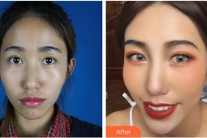 武漢艾格眼科醫(yī)院尹禾整形價(jià)格表附眼部綜合案例展示