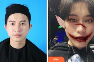 武漢艾格眼科醫(yī)院何荔軍整形價(jià)格表附眼部綜合案例展示