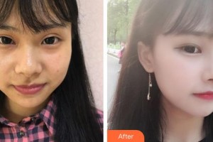 黃石愛爾眼科醫(yī)院田永宏整形價格表附埋線雙眼皮案例展示