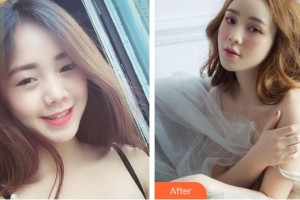 十堰愛爾眼科醫(yī)院王曙亮整形價格表附眼部綜合案例展示