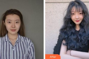 十堰愛爾眼科醫(yī)院王勇整形價格表附眼部修復案例展示