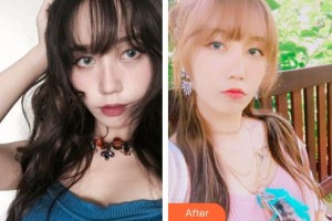 襄陽維多利亞醫(yī)療美容醫(yī)院張世蓮整形價(jià)格表附清潔祛痘案例展示