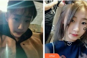 襄陽漢辰醫(yī)療美容門診部楊俊超整形價(jià)格表附光子嫩膚案例展示