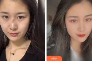 襄陽漢辰醫(yī)療美容門診部郭同榮整形價(jià)格表附激光祛疤案例展示