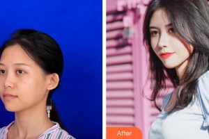 襄陽維多利亞醫(yī)療美容醫(yī)院安邰晥整形價格表附鼻部綜合案例展示