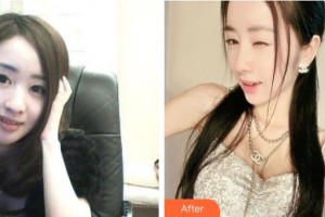 襄陽韓素整形美容門診部周創(chuàng)業(yè)整形價格表附鼻部綜合案例展示