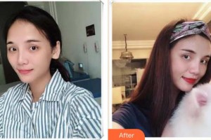 襄陽韓蔻醫(yī)療美容門診部胡乾燕整形價(jià)格表附自體脂肪全臉填充案例展示