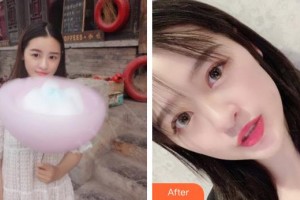 襄陽愛爾眼科醫(yī)院胡天勇整形價(jià)格表附切開雙眼皮案例展示