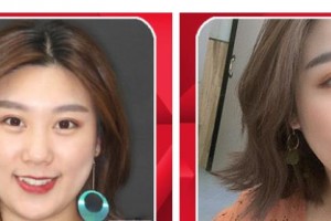 襄陽牙牙口腔門診部李超宏整形價格表附隱形托槽矯正案例展示