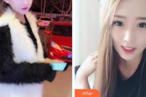 襄陽維樂口腔門診部劉琴整形價格表附牙齒隱形矯正案例展示