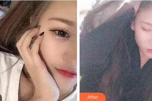 襄陽時(shí)代口腔醫(yī)院耿亞坤整形價(jià)格表附冷光美白案例展示