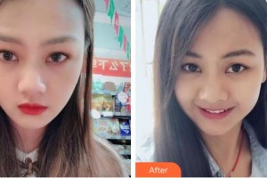 襄陽維樂口腔門診部謝碧亨整形價(jià)格表附牙齒隱形矯正案例展示