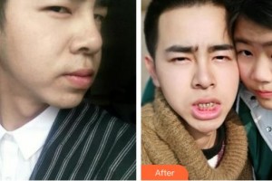 襄陽牙美口腔門診部黃盛興整形價(jià)格表附冷光美白案例展示